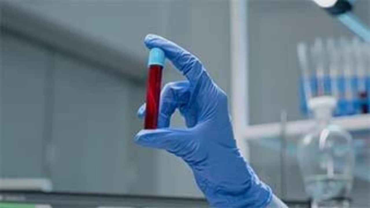 Medilife Home Healthcare Dubai Get a thorough Blood Test in Dubai