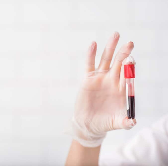 Blood Test at Home in Dubai