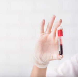 STD Blood testing at home in Dubai