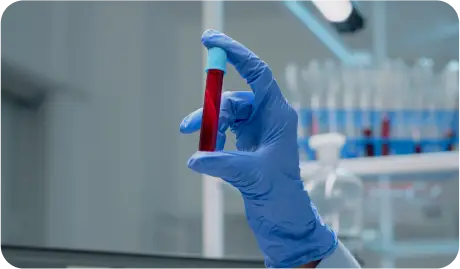 HOME BLOOD TEST IN DUBAI