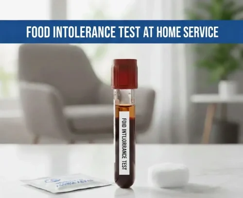 Food Allergy Test Dubai Home Visit