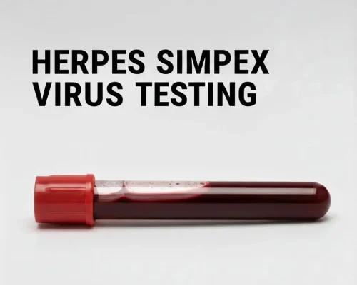 HERPES SIMPLEX VIRUS TESTING AT HOME