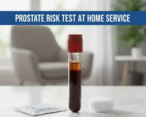 Prostate Risk Test Dubai