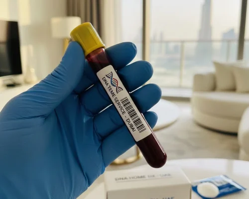 اختبار الحمض النووي في دبيا